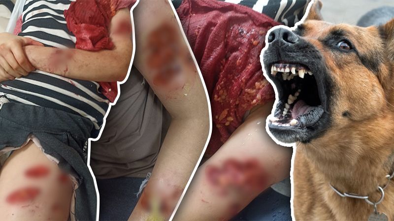 Şanlıurfa'da Sokak Köpekleri Küçük Kızı Parçaladılar