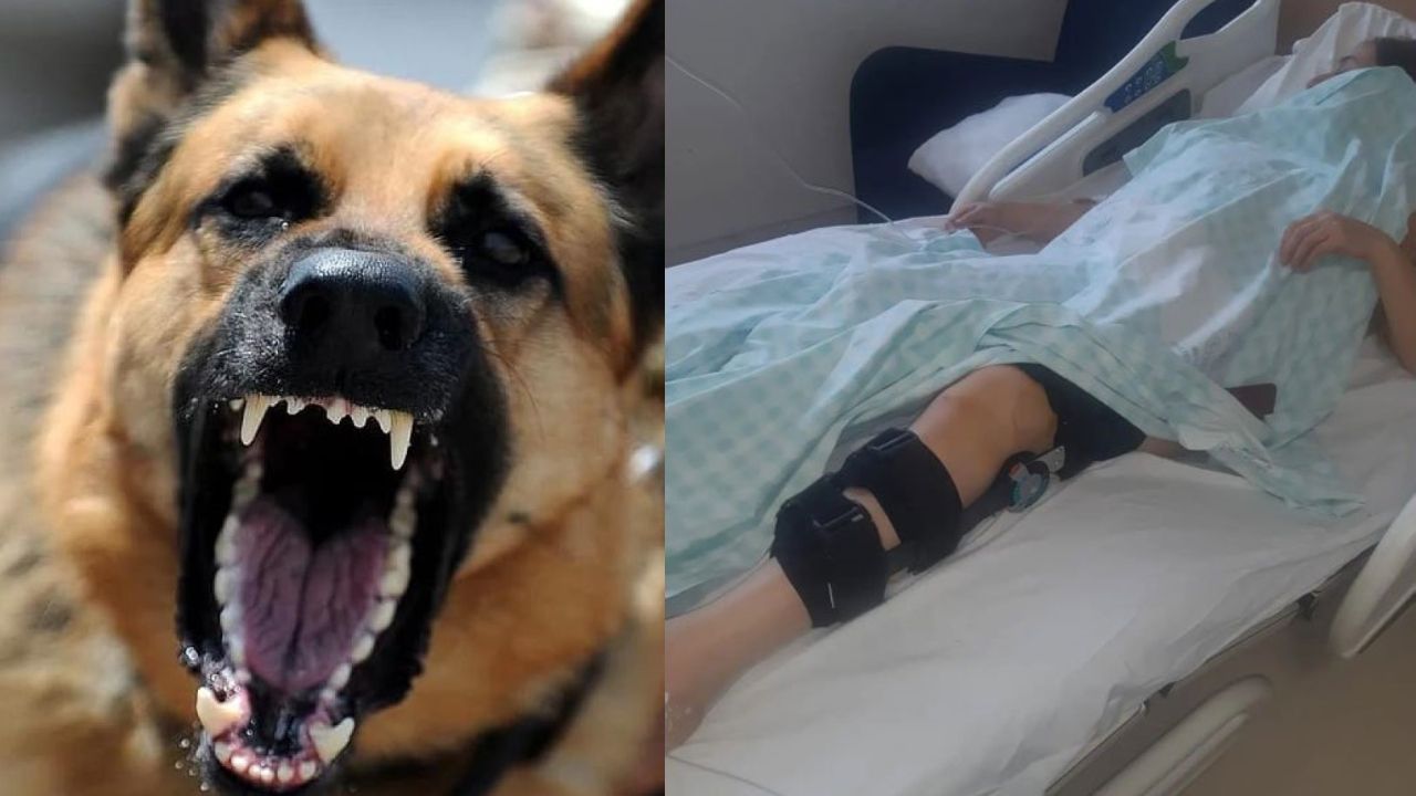 Konya'da Sokak Köpeklerinin Saldırdığı Kadının Ayağı Kırıldı!