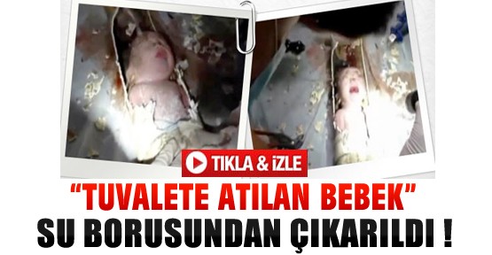 Tuvalete Atılan Bebek Su Borusundan Çıkarıldı-Video